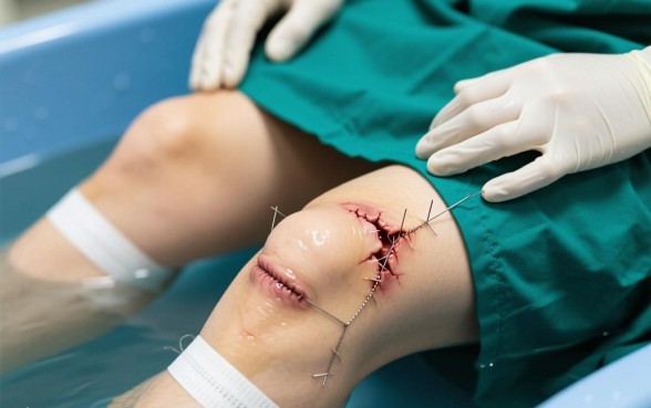 下面缝的口子开了个小口子怎么办