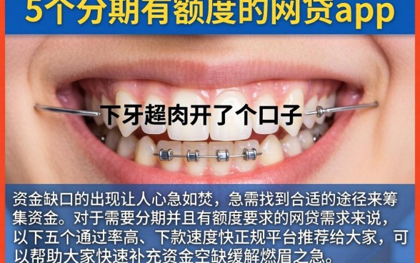 下牙的肉开了个口子,细致阐述5个分期有额度的网贷app