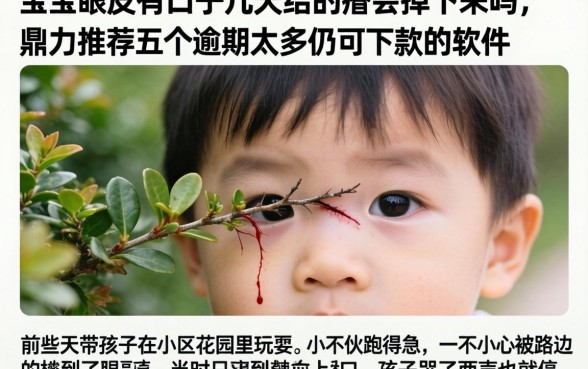宝宝眼皮有口子几天结的痂会掉下来吗，鼎力推荐五个逾期太多仍可下款的软件