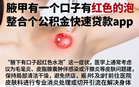 腋下有一个口子有红色的泡，整合五个公积金快速贷款app