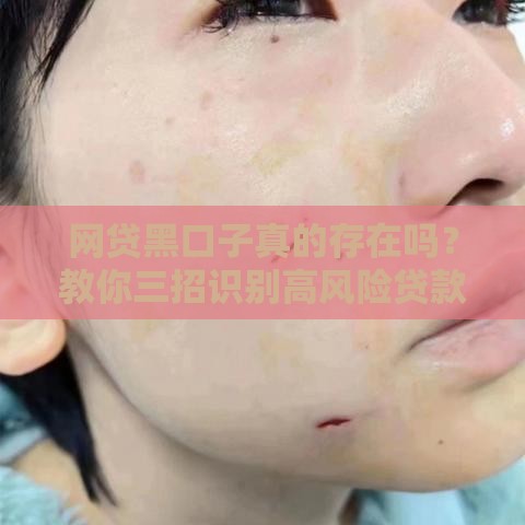 网贷黑口子真的存在吗？教你三招识别高风险贷款