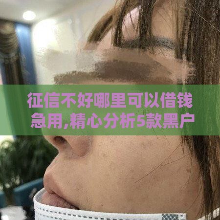 征信不好哪里可以借钱 急用,精心分析5款黑户绝对能下的口子