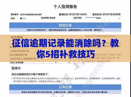 征信逾期记录能消除吗？教你5招补救技巧