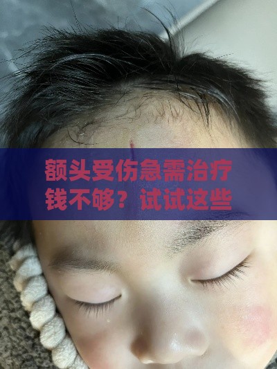 额头受伤急需治疗钱不够?试试这些贷款方案救急! 额头受伤急需治疗钱不够?试试这些贷款方案救急!