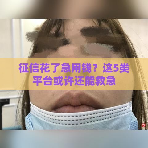 征信花了急用钱？这5类平台或许还能救急