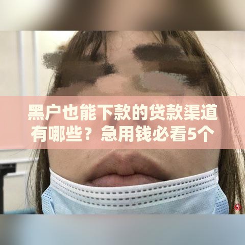 黑户也能下款的贷款渠道有哪些？急用钱必看5个正规方法