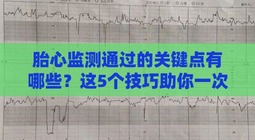 胎心监测通过的关键点有哪些？这5个技巧助你一次过关